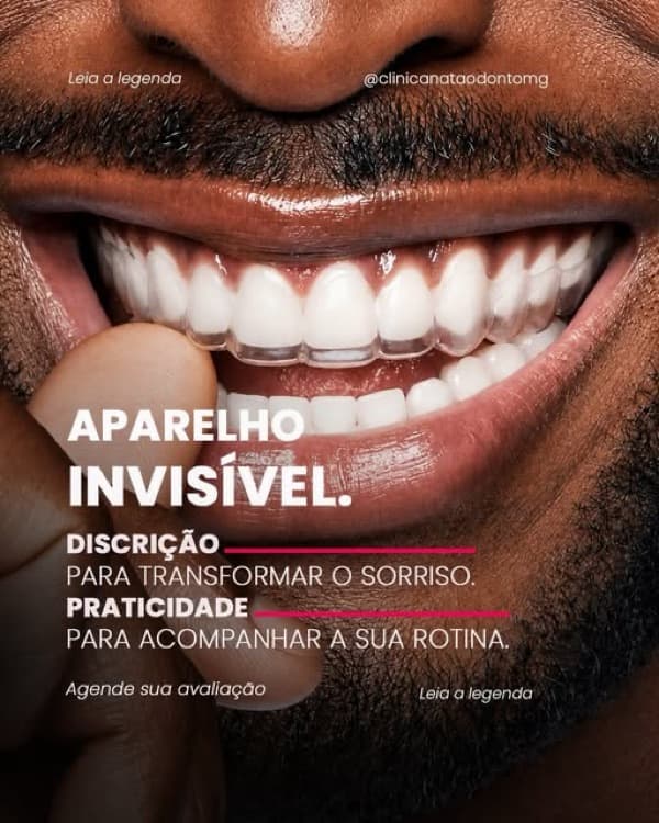 Publicação da Nata sobre aparelho invisível